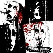 Panonski Sindrom : Ambivalence